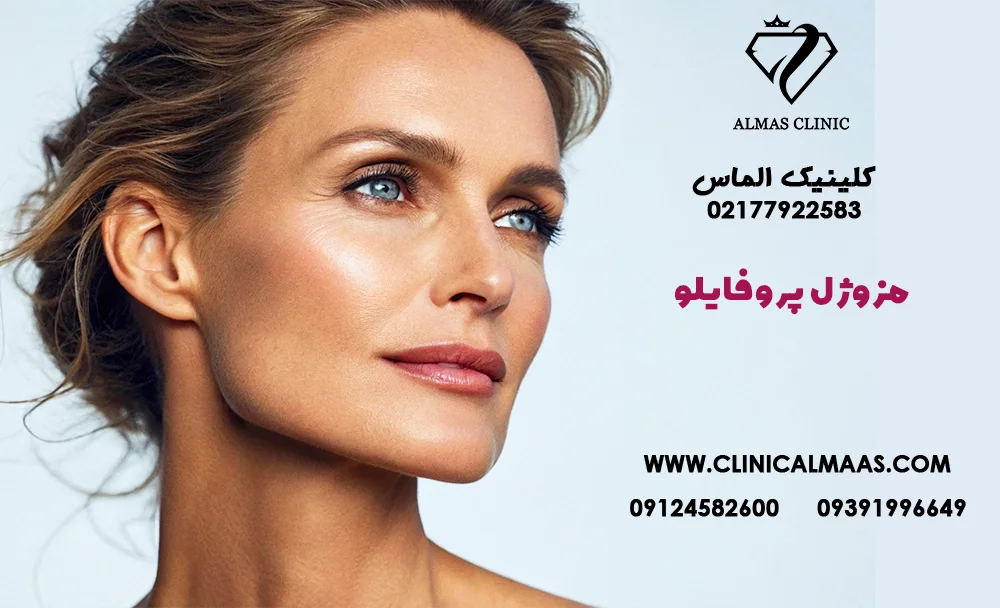 مزوژل پروفایلو